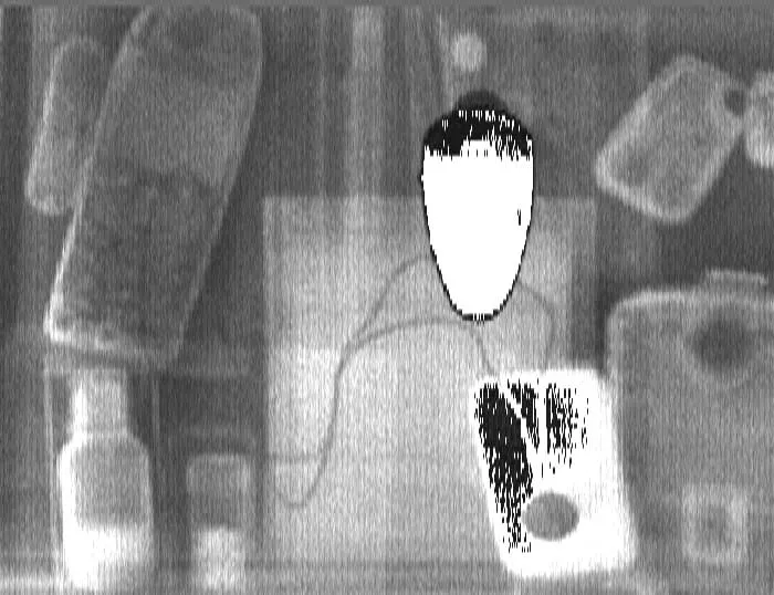 Рентгеновское устройство досмотра полостей Флэш-электроникс "ФЕНИКС"